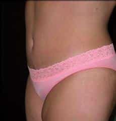 After Image