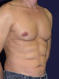 After Image