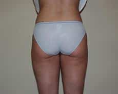 After Image