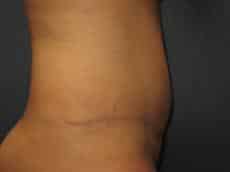 After Image