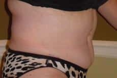 After Image