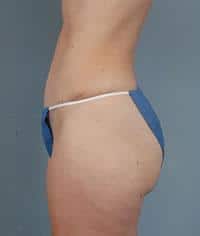 After Image