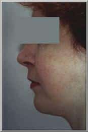 After Image