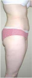 After Image