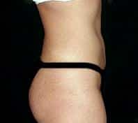 After Image