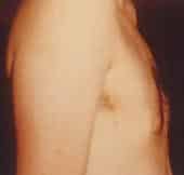 After Image