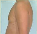 After Image