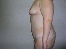 After Image