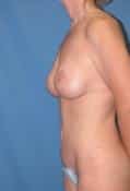 After Image