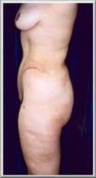 After Image