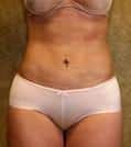 After Image