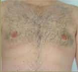After Image