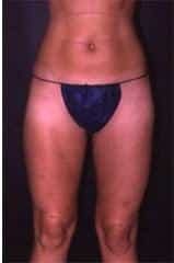 After Image