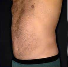 After Image