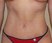 After Image