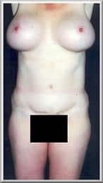 After Image