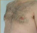 After Image