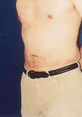 After Image