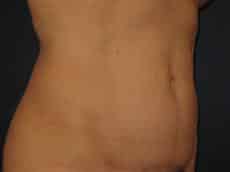 After Image