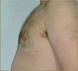 After Image