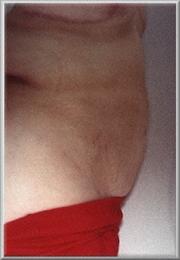 After Image