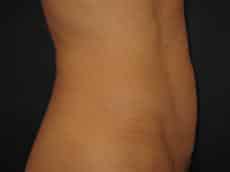 After Image