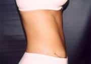 After Image