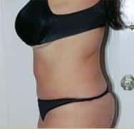After Image