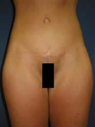 After Image