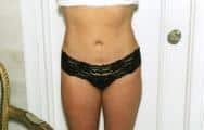 After Image