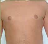 After Image