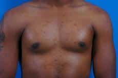 After Image