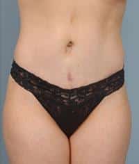 After Image