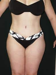 After Image