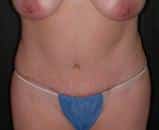 After Image