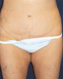 After Image