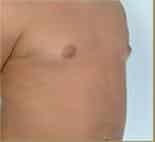 After Image