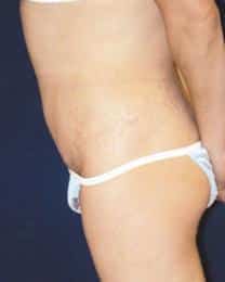 After Image