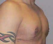 After Image