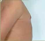 After Image