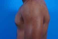 After Image