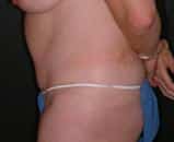 After Image