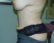After Image