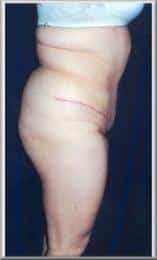 After Image