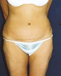 After Image