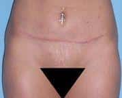 After Image
