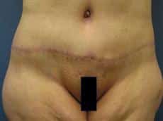 After Image