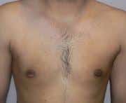 After Image