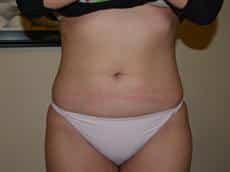 After Image