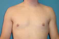 After Image